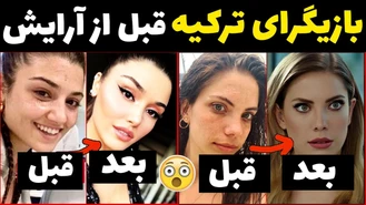 شصت و هشت 68 بازیگر ترکیه ای قبل و بعد از آرایش 😯